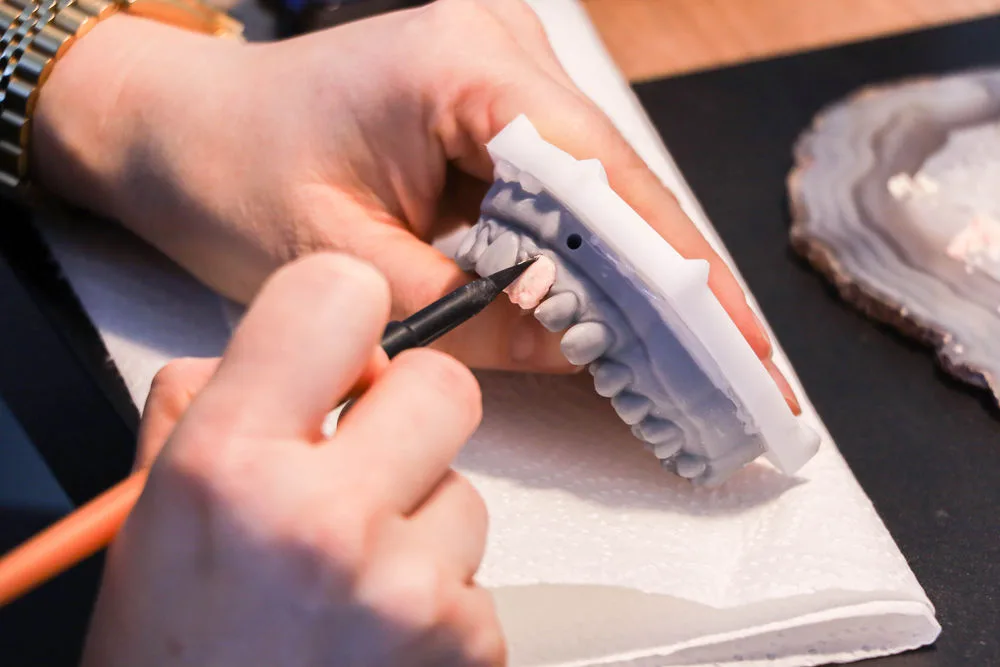 Fogtechnikus egyedi fogpótlást dolgoz ki az Egressy Dental laborjában